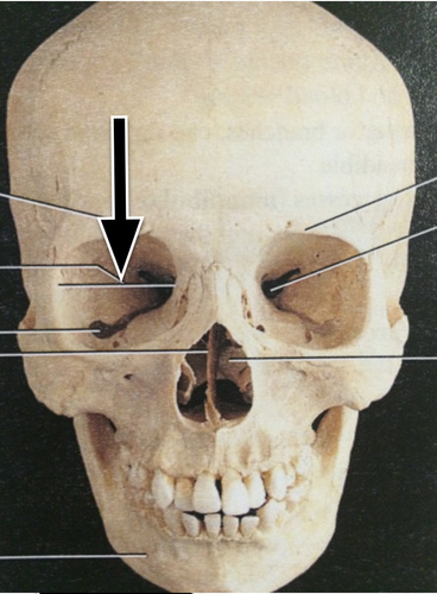 <p>Bony cavity housing the eye.</p>