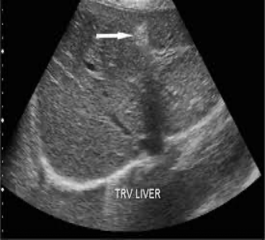 <p>What is the arrow pointing at?</p>