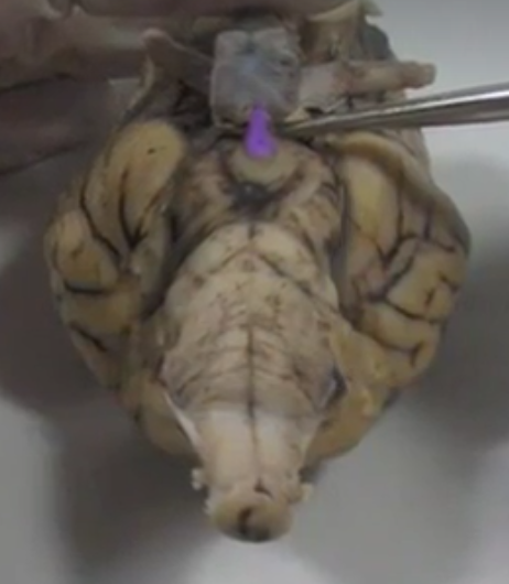 what part of the brain is this?