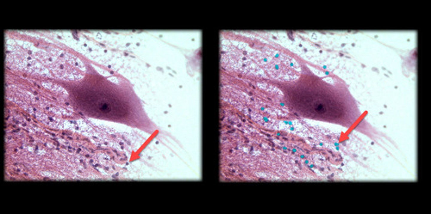 <p>- Smaller, more numerous cells that provide support, protection, and nourishment for neurons.</p><p>- Appear as small, round or oval-shaped cells scattered around the larger neurons, often with a more uniform or darkly stained nucleus.</p><p>- Can vary in shape depending on the specific type (e.g., astrocytes, oligodendrocytes, microglia), but they are typically much smaller than neurons.</p><p>- Found throughout the central and peripheral nervous system, often near or surrounding neurons.</p>