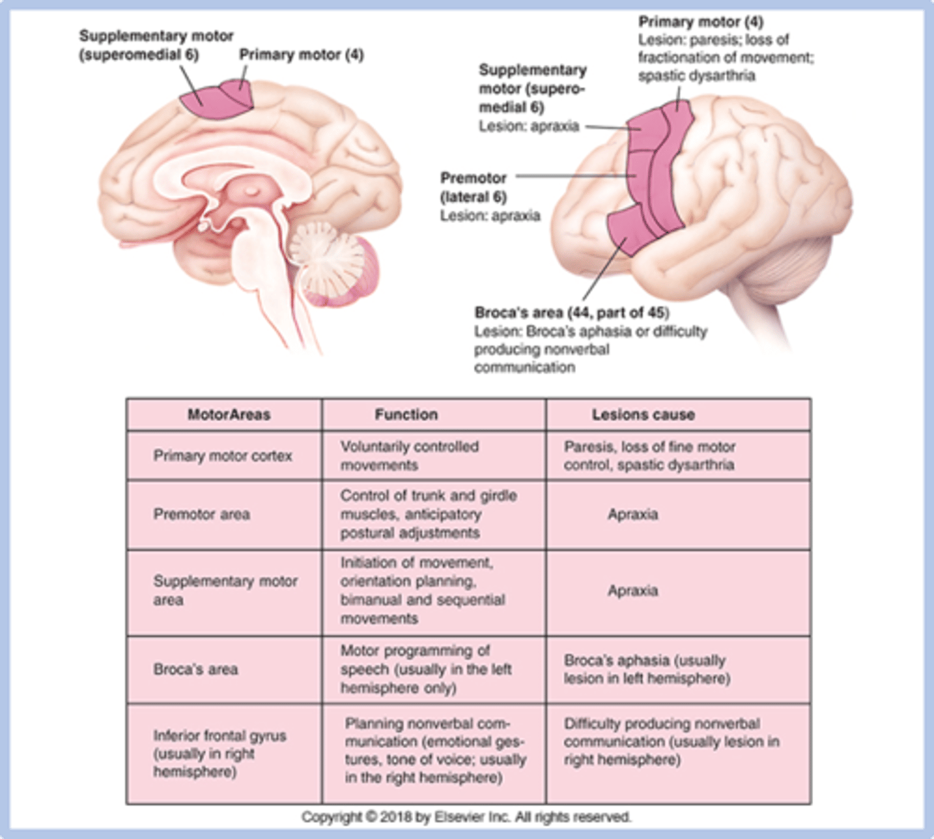 <p>premotor, supplementary motor, Brocas, Area corresponding to Broca's in the opposite hemisphere</p>