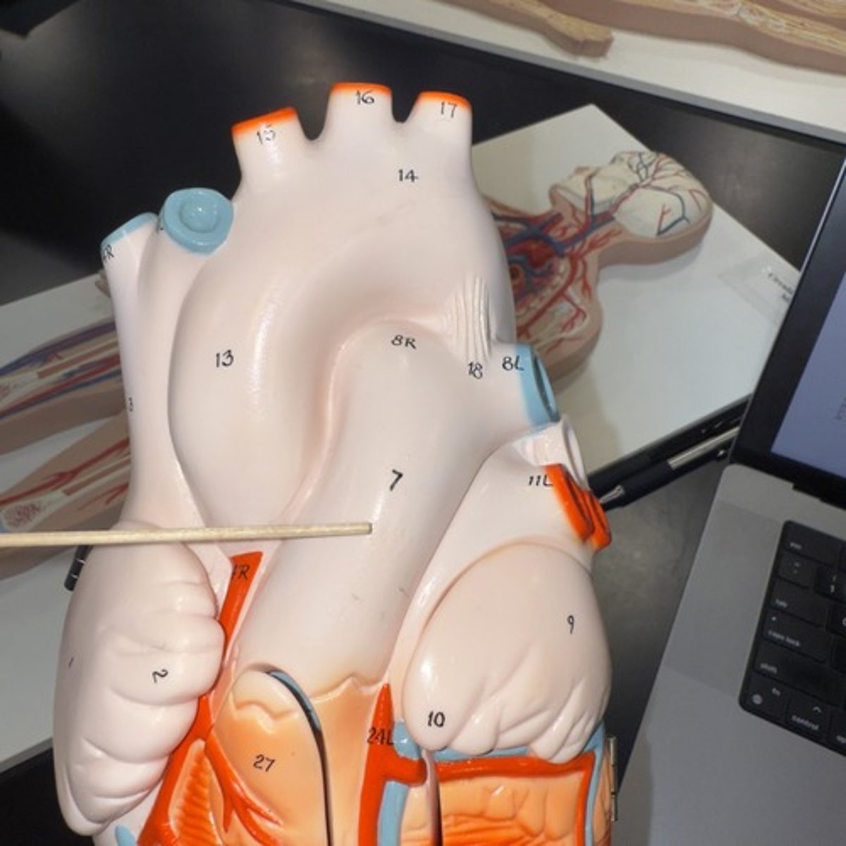 <p>Identify the structure.</p>