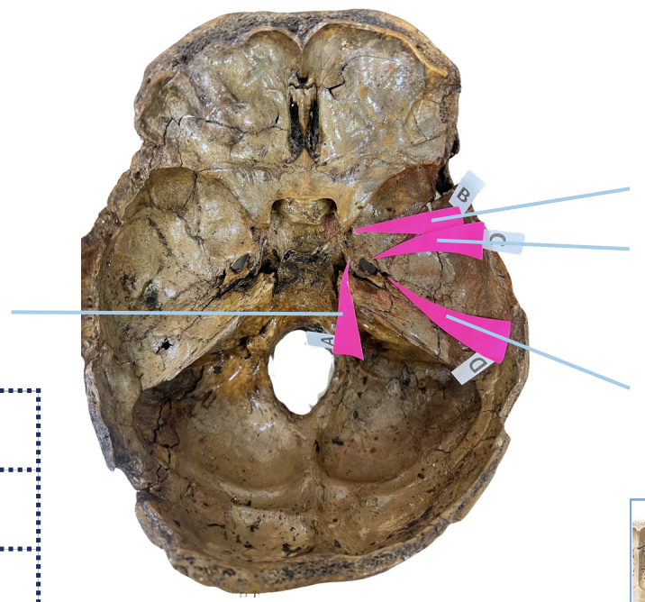 <p>Identify the foramen of the skull labelled as A.</p>