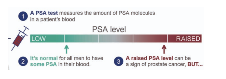 <ul><li><p>prostate specific antigen (PSA) is a protein produced by the prostate and plays an important role in fertility</p></li><li><p>in prostate cancer, <strong>blood levels of PSA will increase</strong></p></li><li><p>PSA test measures blood levels of PSA by ELISA</p><ul><li><p>normal for all men to have some PSA in their blood</p></li></ul></li></ul><p></p>
