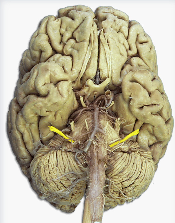 <p>Label this cranial nerve</p>