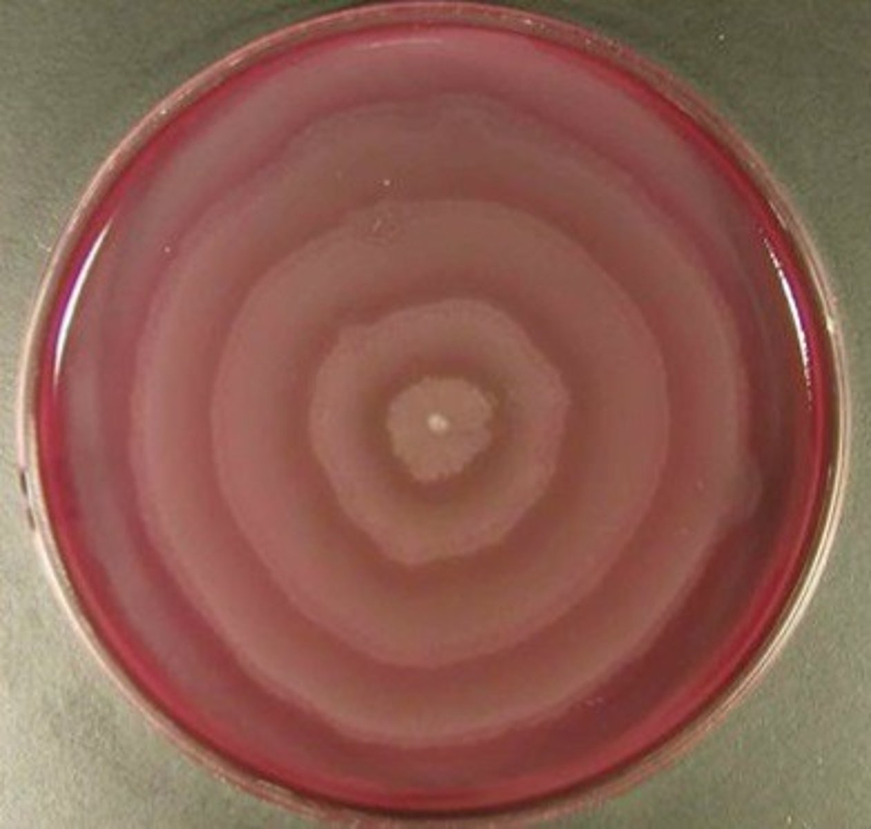 <p>- swarm on surface of moist agar in a concentric pattern</p><p>- UTI, wound infections, pneumonia, septicemia, &amp; infant diarrhea</p>