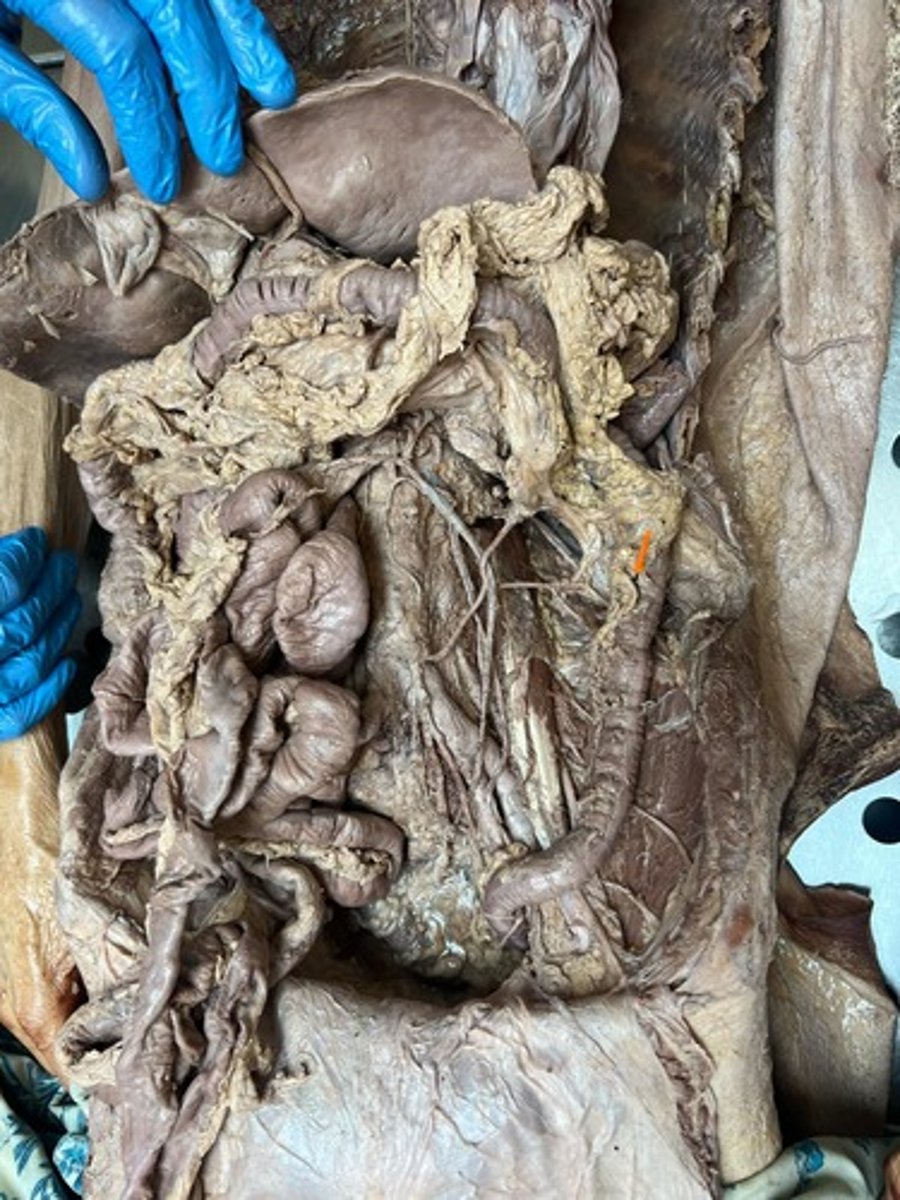 <p>descending colon</p>