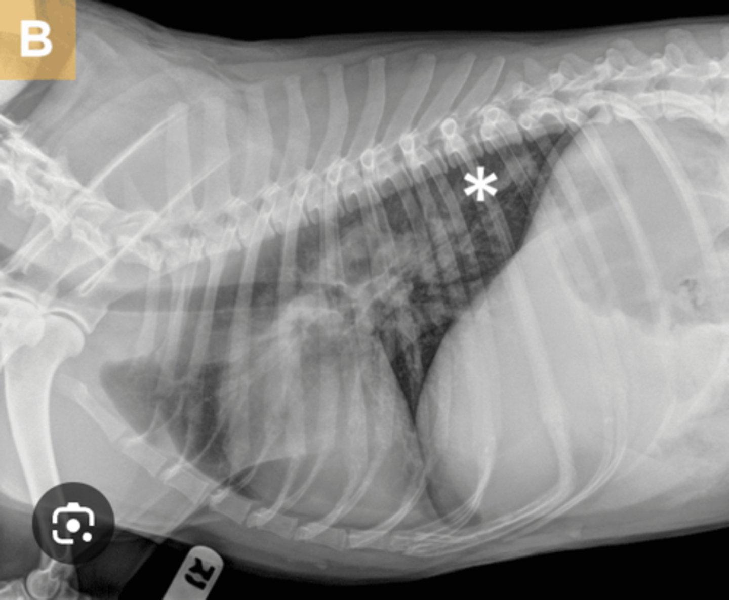 <p>What radiographic finding of this dog with Heartworm disease?</p>