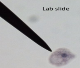 <p>MOT: Contact with amoeba in contaminated soil or water</p><p>Infective stage: Trophozoite or cyst</p><p>Hosts: human</p><p>Parts to look for: Karyosome takes up half of the nucleus</p>