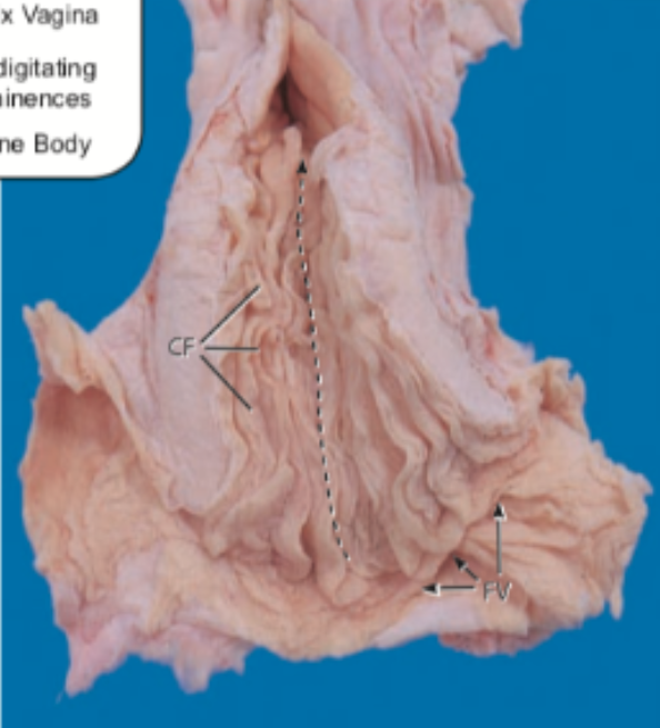 <p>This image is of the _____ cervix. </p>