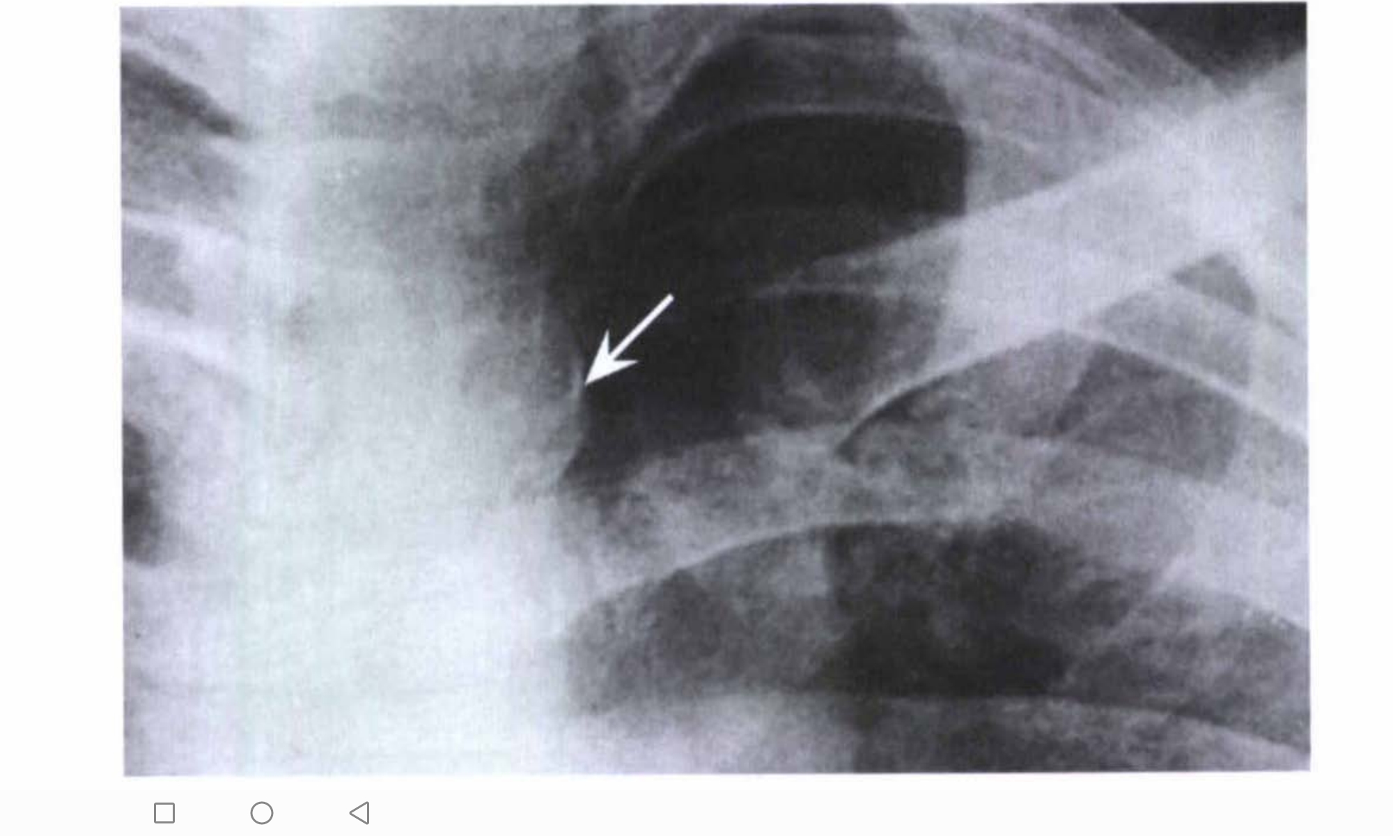 term image