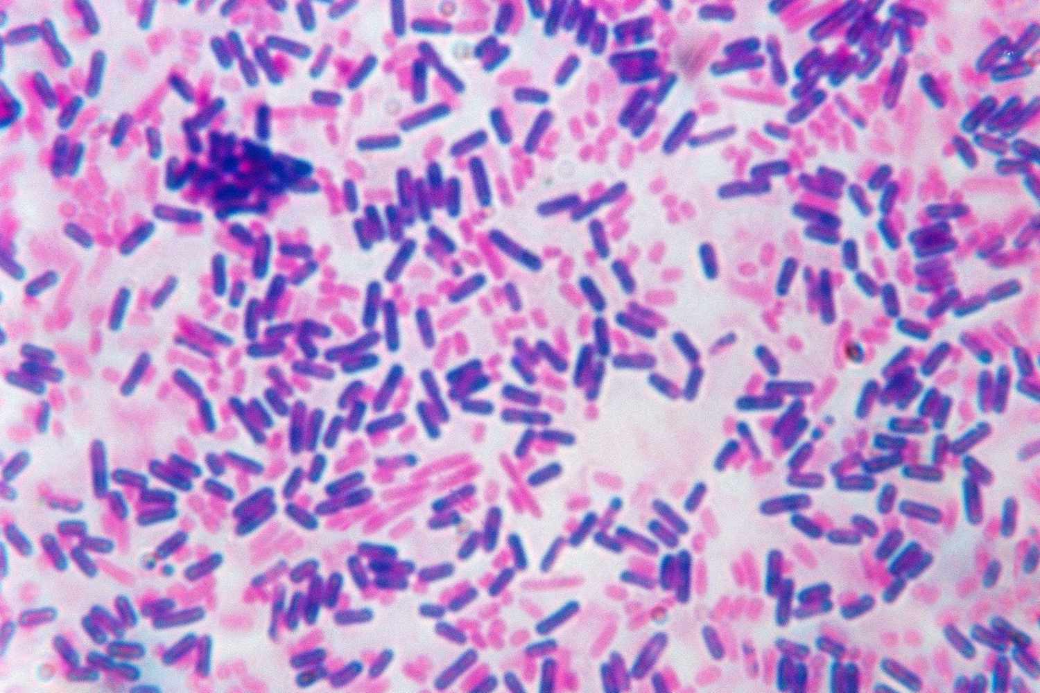 <p>Stain method. Used for routine staining of bacteria in smears. Stains gram + bacteria purple/blue and gram - bacteria pink/red</p>