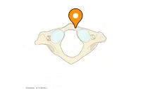 <p>the small flat arch on the anterior side of the C1 vertebra - anterior tubercle is the bump</p>