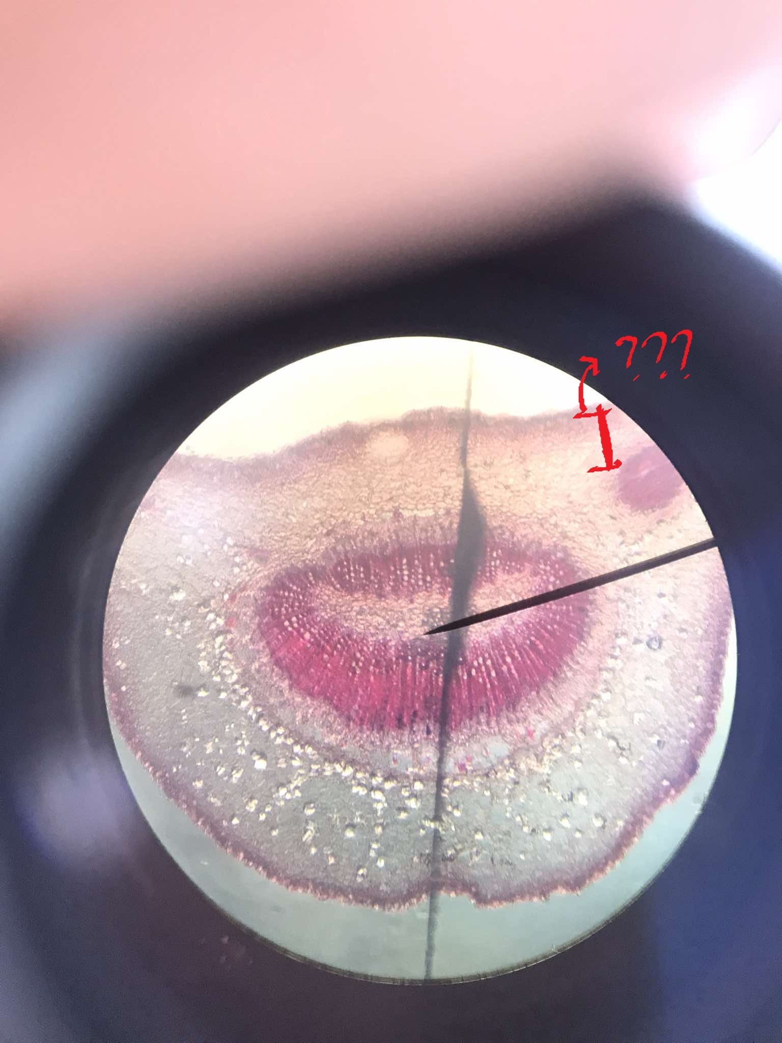 <p>parenchymatous regions located adaxially from the diverging leaf traces</p>