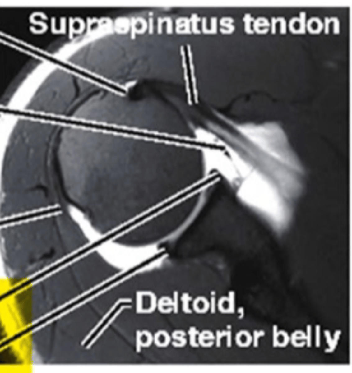<p>what type of imaging is this</p>