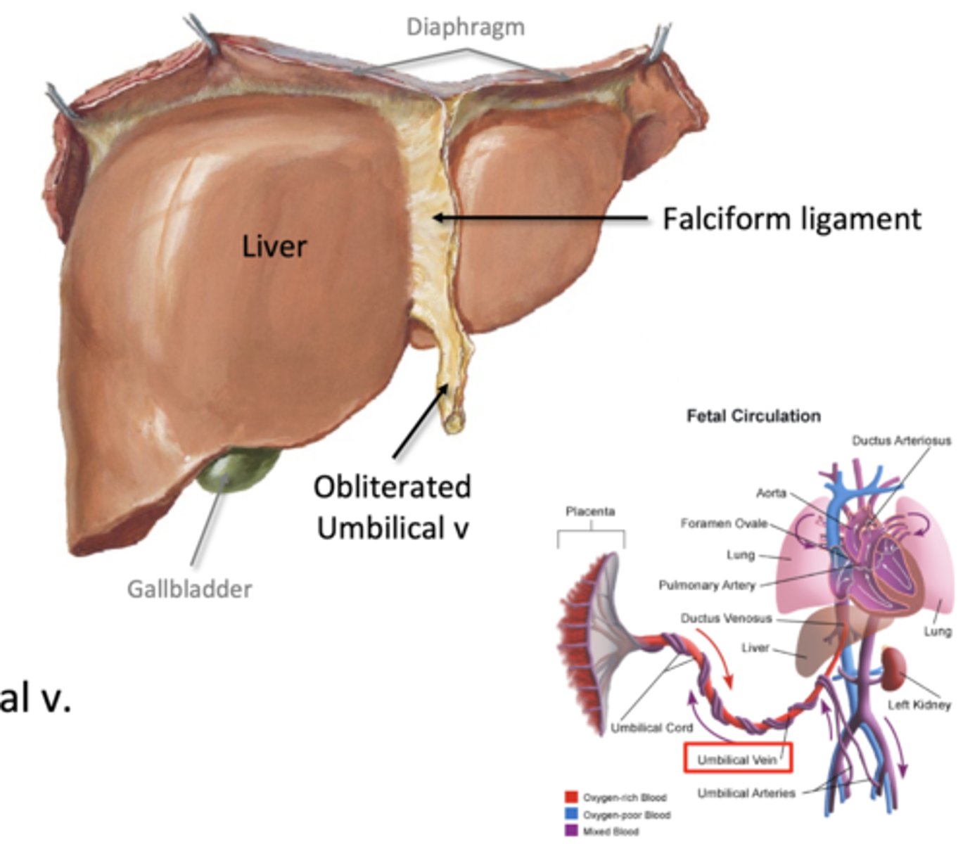 <p>liver to anterior wall</p><p>-pathway of obliterated umbilical vein (round ligament)</p><p>-extends to the umbilicus (belly buttone)</p>