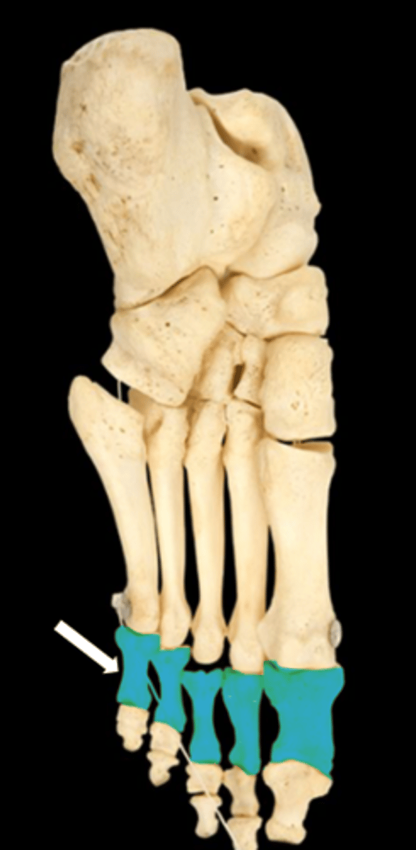 <p>name the part</p>