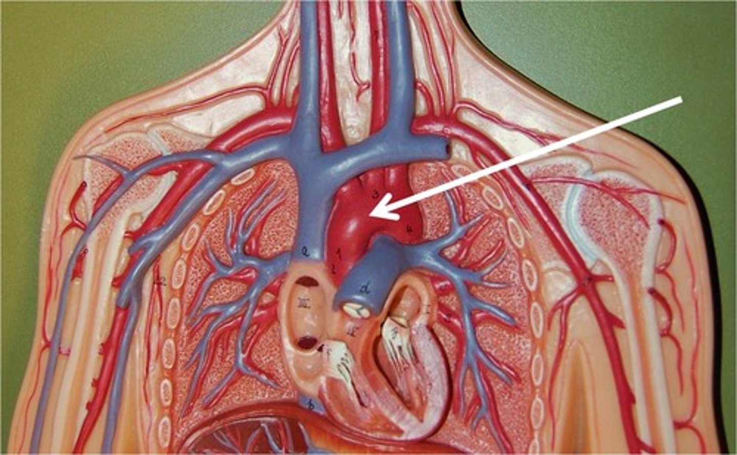 <p>Name the blood vessel.</p>