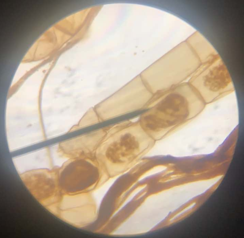 <p>Chlorophyta; common freshwater filamentous green alga; pondscum organism; form green masses on the surface of ponds and streams; chloroplasts are arranged in a spiral within a cell; conjugation; produces aplanospores</p>
