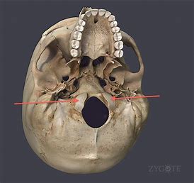 <p>what bone structure are the arrows pointing to?</p>