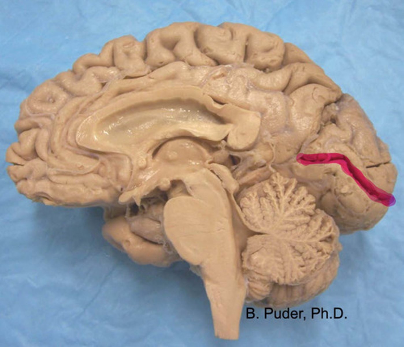 <p>what is highlighted?</p>