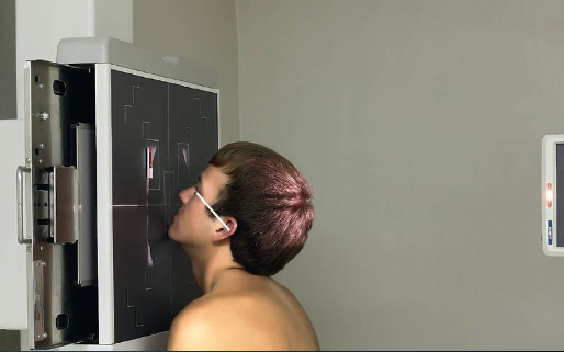 <ul><li><p>patient position:</p><ul><li><p>upright</p></li><li><p>MSP centered to midline</p></li></ul></li><li><p>part position:</p><ul><li><p>rest chin on vertical grid devie</p></li><li><p>hyperextend neck to place OML at 37 degree angle from IR</p></li><li><p>MSP and MML perpendicular to IR</p></li><li><p>center IR to acanthion</p></li></ul></li><li><p>respiration suspended</p></li><li><p>CR:</p><ul><li><p>horizontal, exits acanthion</p></li></ul></li><li><p>collimation:</p><ul><li><p>1 inch beyond the lateral skin shadows, superiorly to include just the shadow of the top of the head, and inferiorly to the occulsal plane</p></li></ul></li></ul><p></p>
