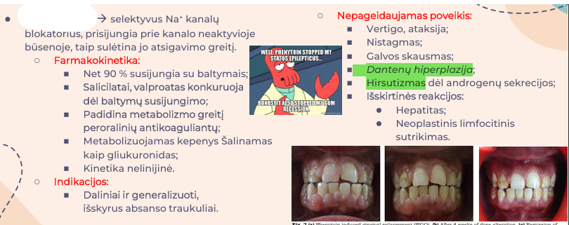 <p>selektyvus Na+kanalų blokatorius, prisijungia prie kanalo neaktyvioje būsenoje, taip sulėtina jo atsigavimo greitį.</p>