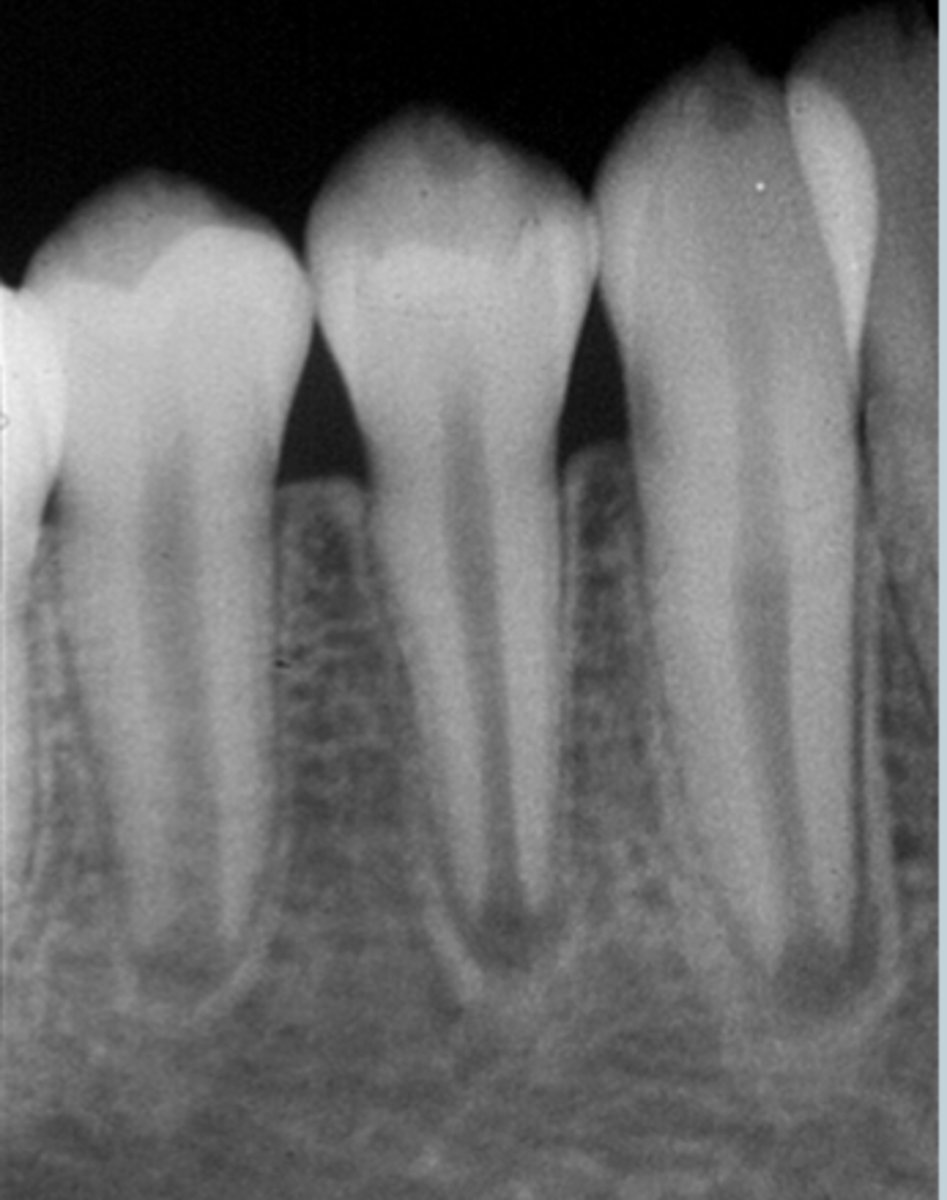 <p>what is going on</p><p>thickened, normal, thin, etc.</p>