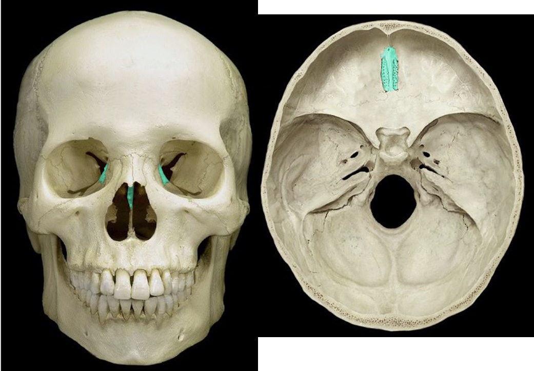 <p>Identify the bone.</p>