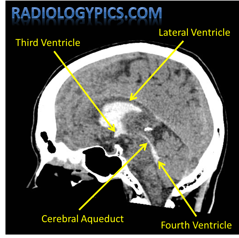 <p>Between the thalamus</p>