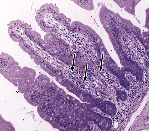 <p>typical of the lining of the digestive tract </p><p>apical surface has a brush border (microvilli)</p>