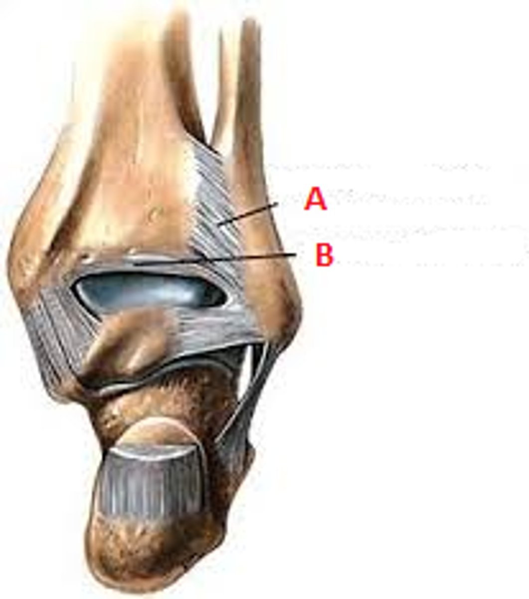<p>B</p>