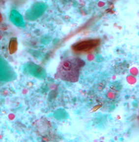 <p>Professor: Dr. Glena Fe A. Yapchulay-Alcabasa</p>