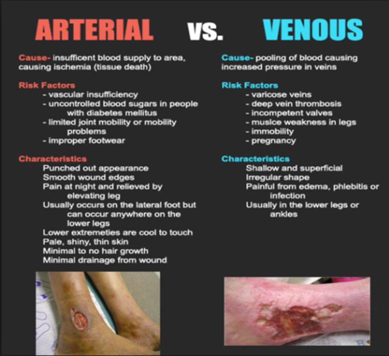<p>What: venous thrombosis, varicose veins, and others</p><p>Clinical Presentation:</p><p>-proximal to medial malleolus wounds</p><p>-irregular, shallow appearance</p><p>-Painless and superficial wounds with good peripheral pulse</p><p>-Edema present and hemosiderinosis of the skin</p><p>-mild to moderate pain but elevation decreases pain</p><p>Tx:</p><p>-elevation and compression for edema</p><p>-Active exercise</p><p>-compression stockings for LT management</p>