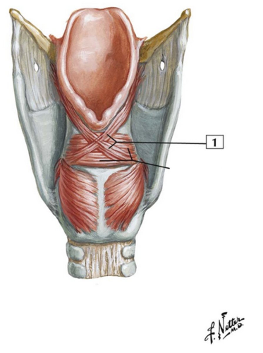 <p>1 in image</p><p>the “X” itself </p><ul><li><p>strucutre</p></li></ul><p></p>