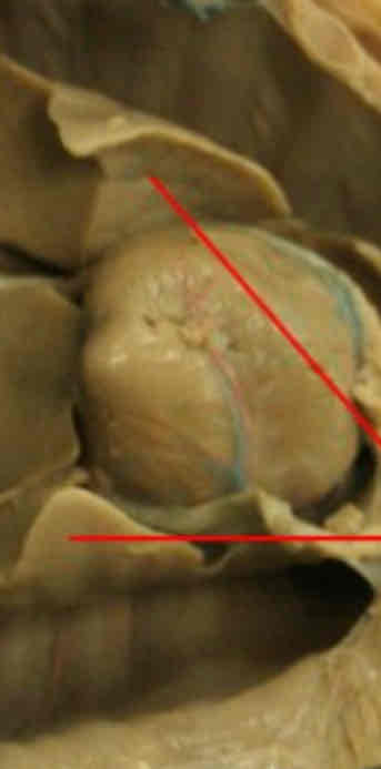 <p>Identify this structure</p>