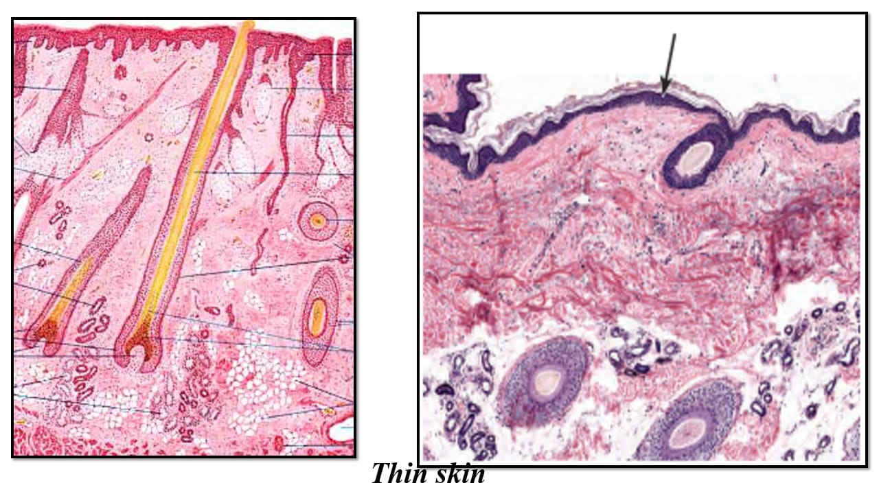 <p>Term 51</p>