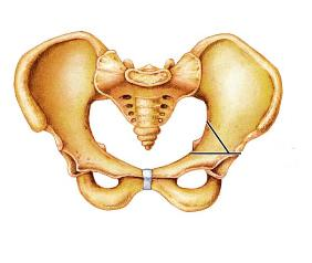 <p>Is this pelvis male or female?</p>