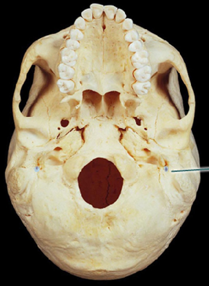 <p>cranial nerve passageways between mastoid process and styloid process</p>