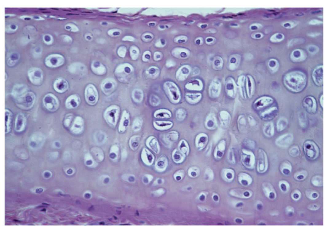 <p>What cartilage is this?</p>