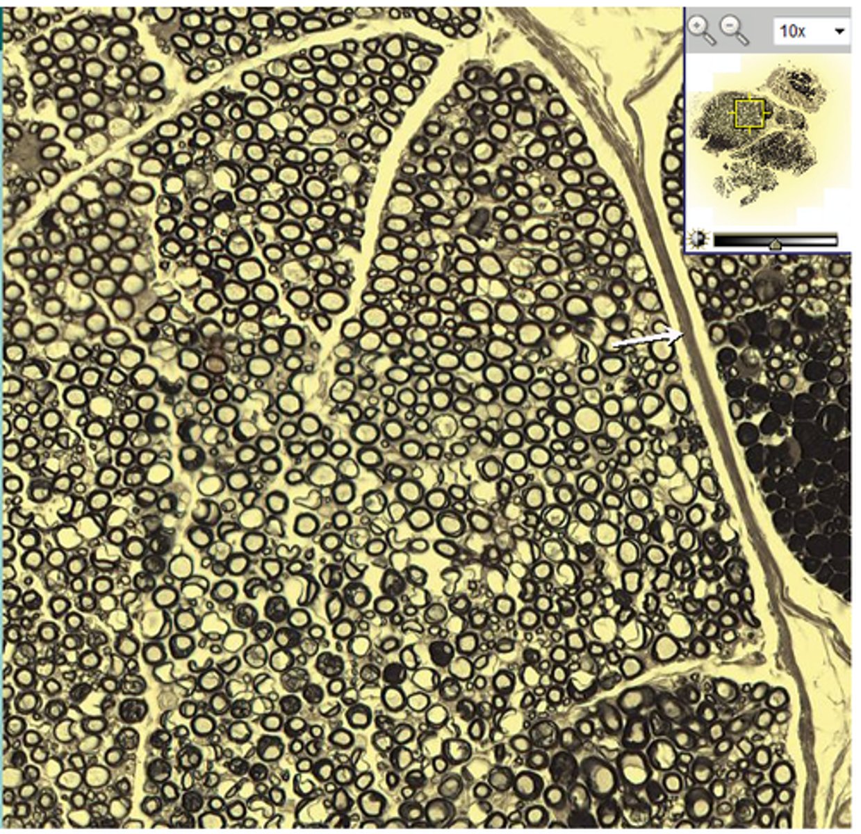 <p>Connective Tissues wrap around... (visible in cross section of myelinated peripheral nerve)</p>