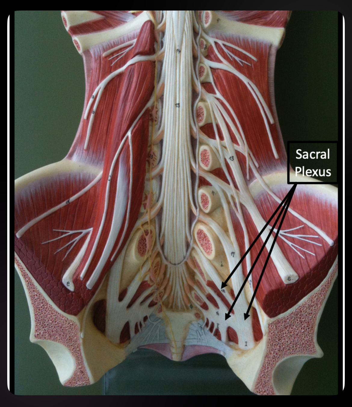 <p>Sacral Plexus</p>