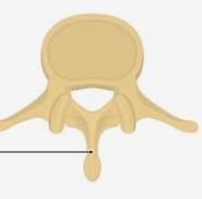 <p>What structure of the vertebra is this? </p>