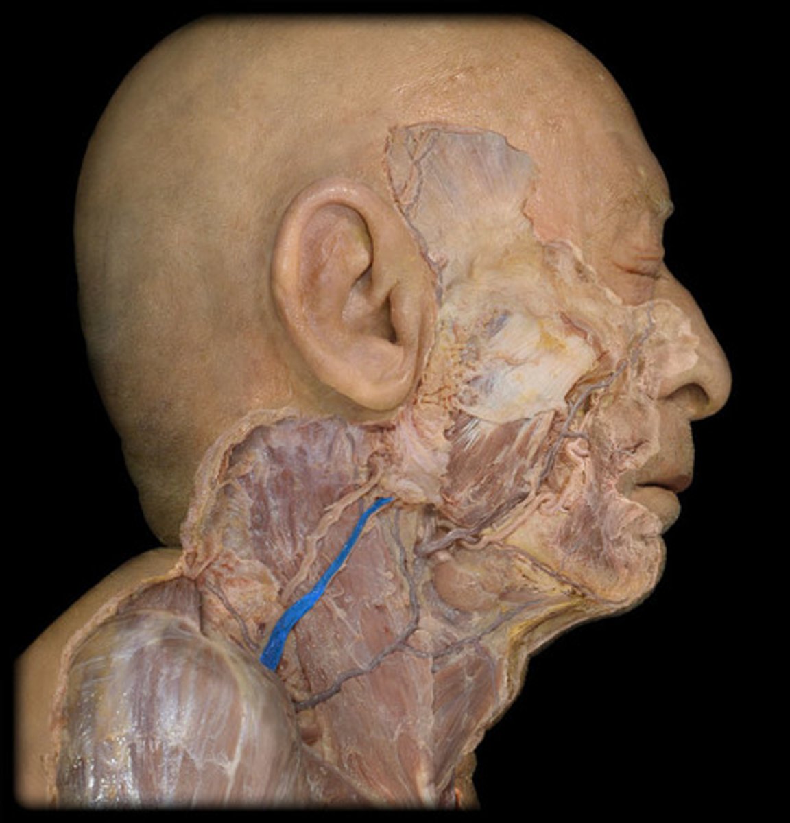 <p>Lateral and smaller vein.</p>