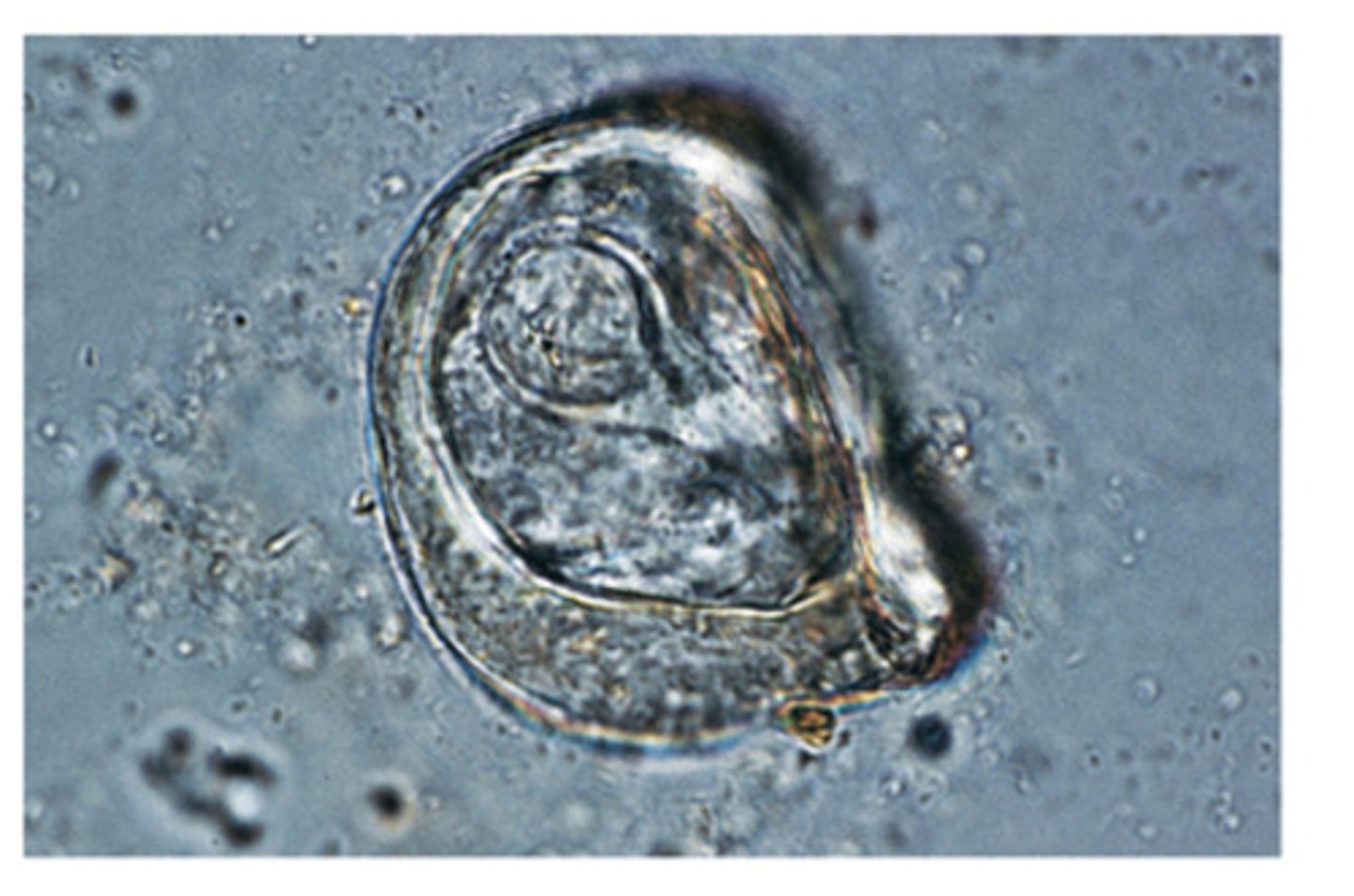 <p>This tapeworm ovum belongs to the equine tapeworm ___. The ovum is the largest of 3 equine tapeworms</p>