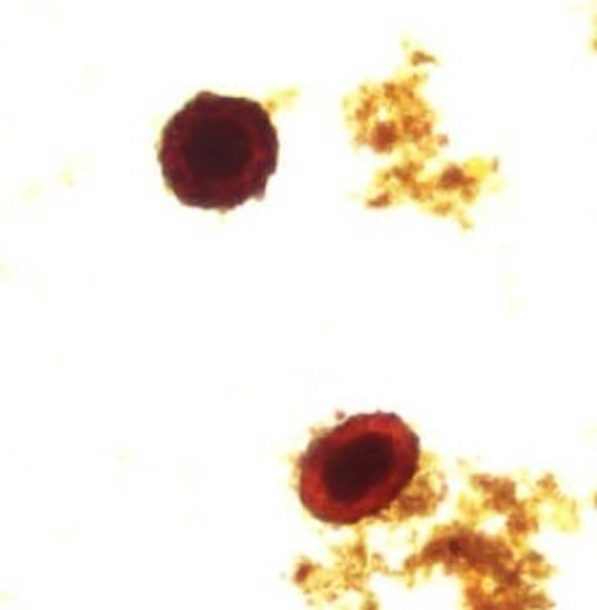 <p>Identify the parasite</p>