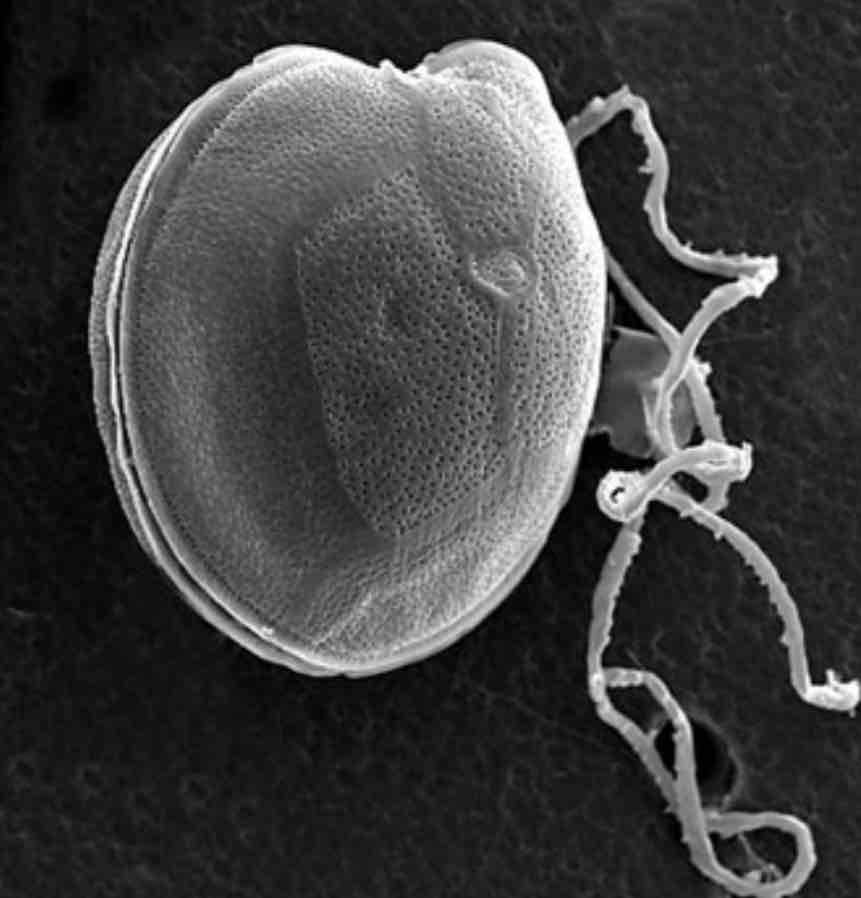 <p>Intossicazione alimentare causata da ingestione di alimenti marini contaminati da <u>ciguatossina</u>, presente in molti dinoflagellati</p><p>I sintomi comprendono prurito, contrazioni muscolari involontari, visione offuscata…</p><p>Solitamente associata al consumo di pesci provenienti da mari tropicali</p>