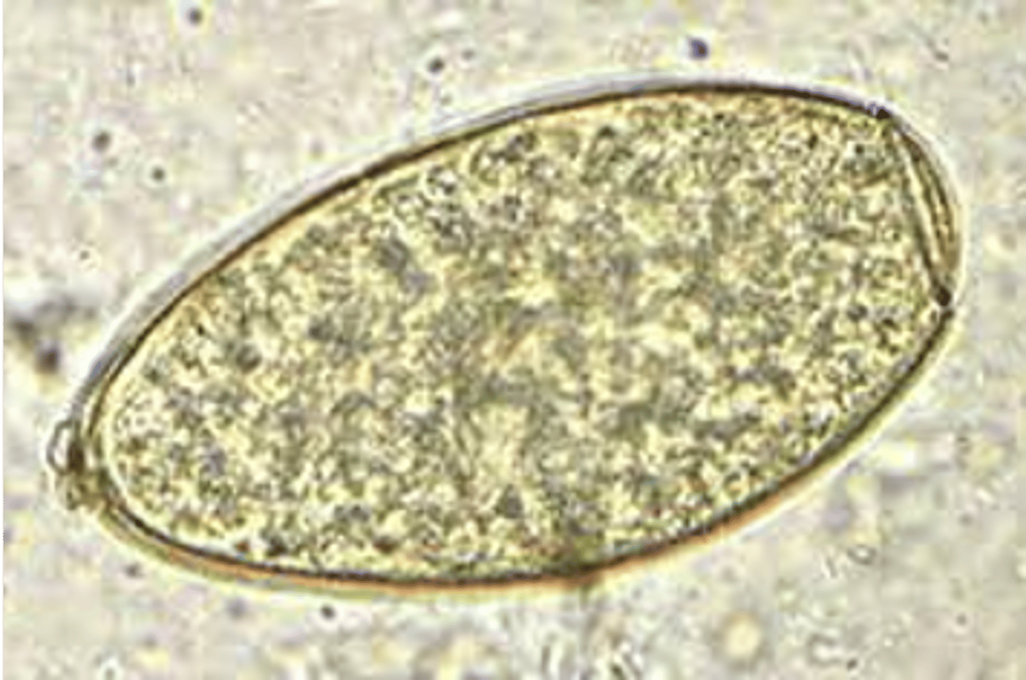 <p>larger then C. sinensis, is oval and has small lid on top (operculum)</p>
