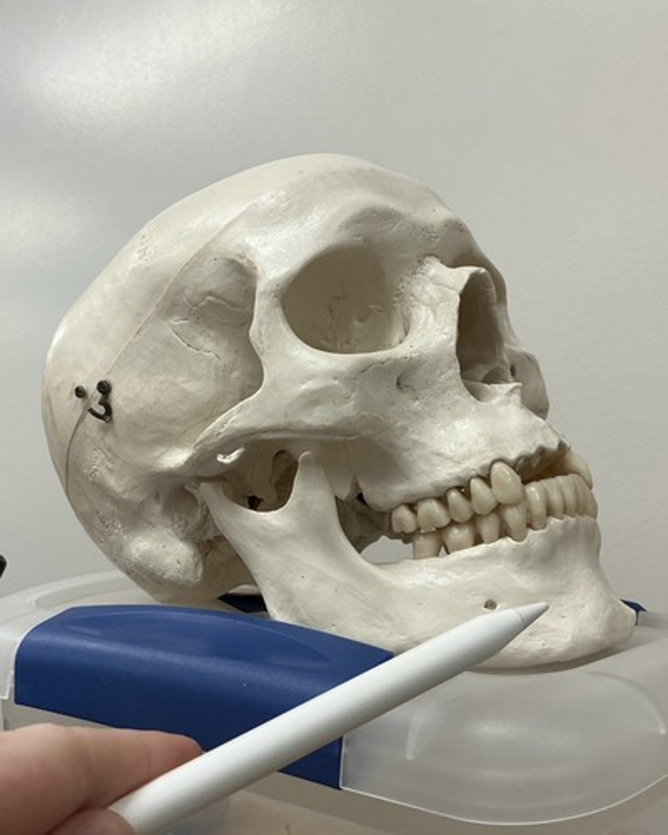 <p>What bone is this?</p>