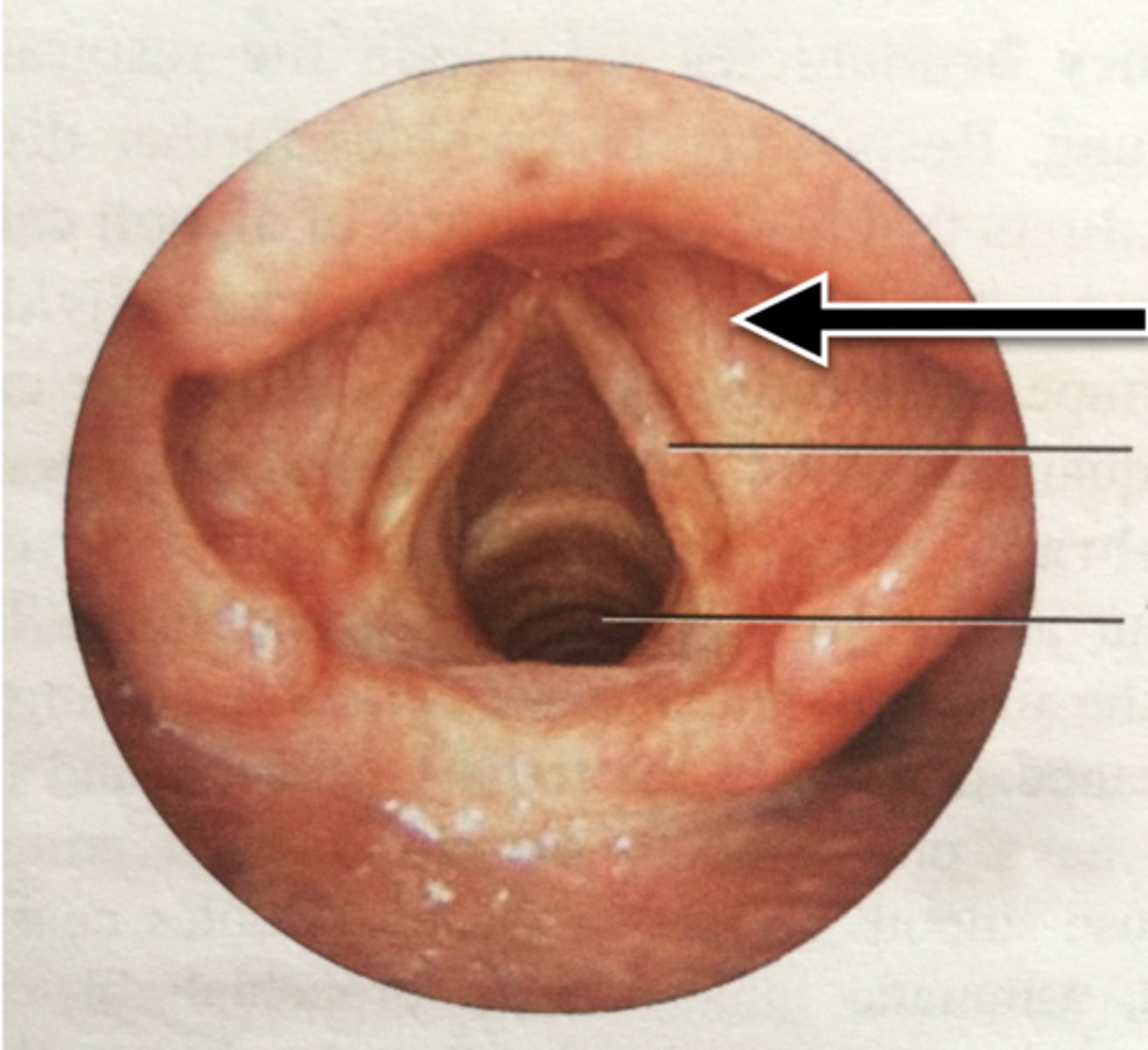 <p>Folds of tissue in the larynx that do not produce sound but help protect the vocal cords.</p>